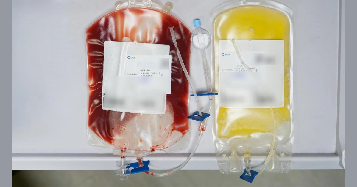 Two cell-collection bags with identifying label details obscured