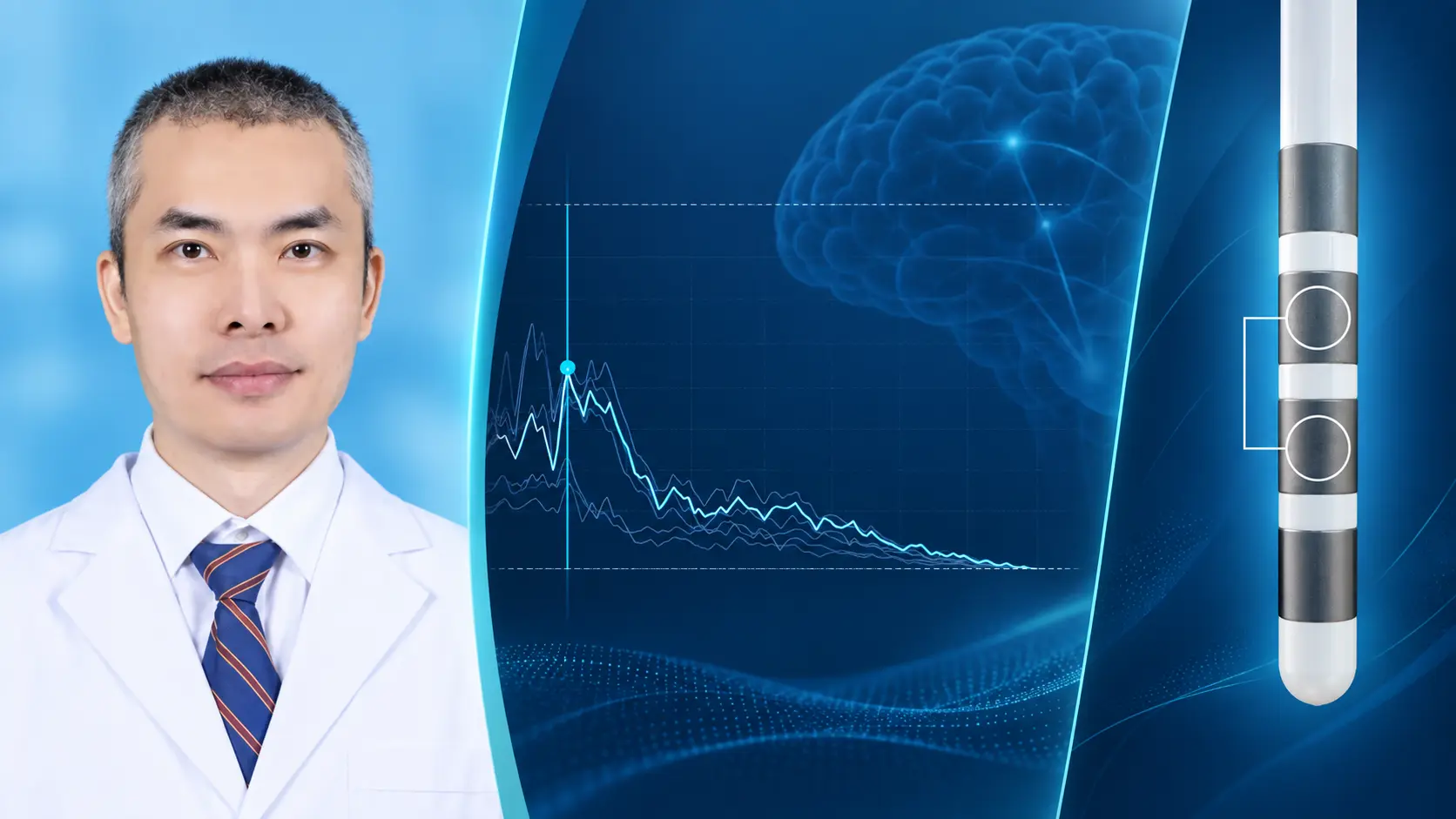 AI-enhanced editorial composite of Dr Yang Chao, an LFP waveform and a DBS lead